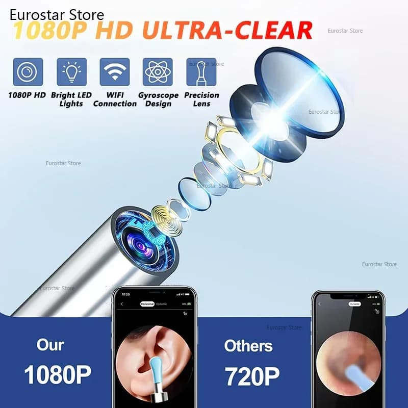 Kamera do czyszczenia uszu z wizualizacją – bezpieczny endoskop do usuwania woskowiny z kamerą 5 MP, podświetleniem LED, otoskop do higieny uszu